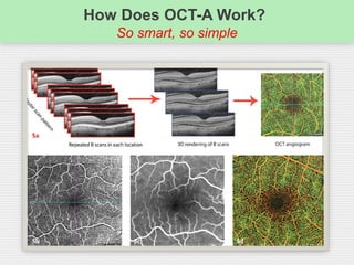 How Does OCT-A Work?
So smart, so simple
 