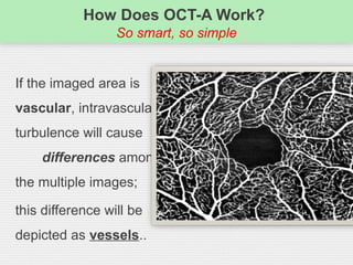 How Does OCT-A Work?
So smart, so simple
If the imaged area is
vascular, intravascular
turbulence will cause
differences among
the multiple images;
this difference will be
depicted as vessels..
 