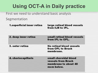 Using OCT-A in Daily practice
First we need to understand basic analysis
Segmentation
 
