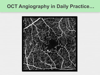 OCT Angiography in Daily Practice…
 