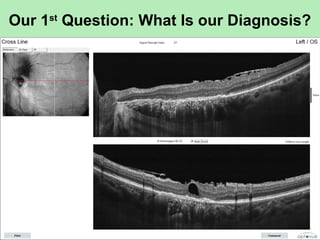 Our 1st
Question: What Is our Diagnosis?
 