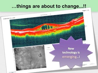 …things are about to change...!!
 