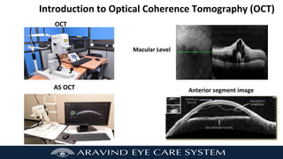 Introduction to Optical Coherence Tomography (OCT)
Macular Level
OCT
AS OCT Anterior segment image
 