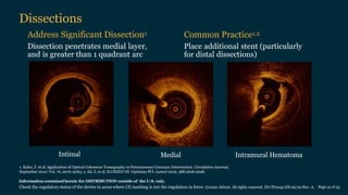 Oct Dissection Grading OCT -INTERPRETATION.pptx