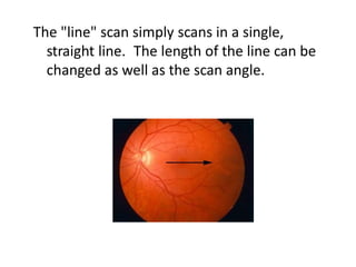 Optical coherence tomography(OCT) --macula | PPTX