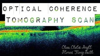 Optical Coherence
Chua, Chelsi Aryll
Flores, Novy Faith
Tomography scan
 