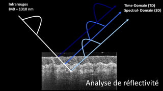 Infrarouges 
840 – 1310 nm 
Time-Domain (TD) 
Spectral- Domain (SD) 
Analyse de réflectivité 
 