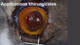 Applications chirurgicales 
 