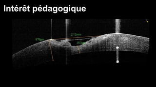 Intérêt pédagogique 
 