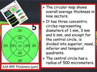 Ilm Rpe Thinkness Numbers Example OCT | PDF