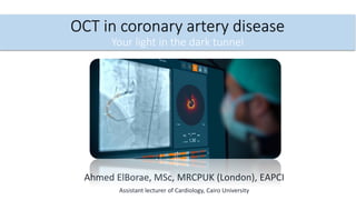OCT in coronary artery disease
Your light in the dark tunnel
Ahmed ElBorae, MSc, MRCPUK (London), EAPCI
Assistant lecturer of Cardiology, Cairo University
 