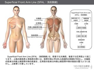 Superficial Front Arm Line (SFALǳǰ) ϡǰǤϴؽǤώڱ
ޤȺȺgˤϡgиȺФĤԤθڤڤؽ
νڂgиǰ򡢎ڱνڂgи򸲤褦
ФǤ˸ŤƤޤ
 