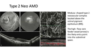 OPTICAL COHERENCE TOMOGRAPHY ANGIOGRAPHY | PPTX