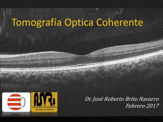 Tomografía Optica Coherente
Dr. José Roberto Brito Navarro
Febrero 2017
 