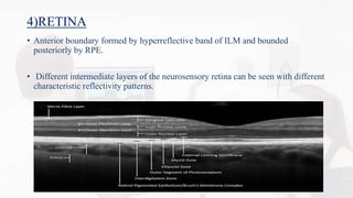 Ilm Rpe OCT MACULA INTERPRETATION. | PPTX