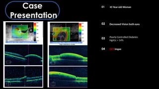 OCT Artifacts in Retinal Imaging and processing | PPTX