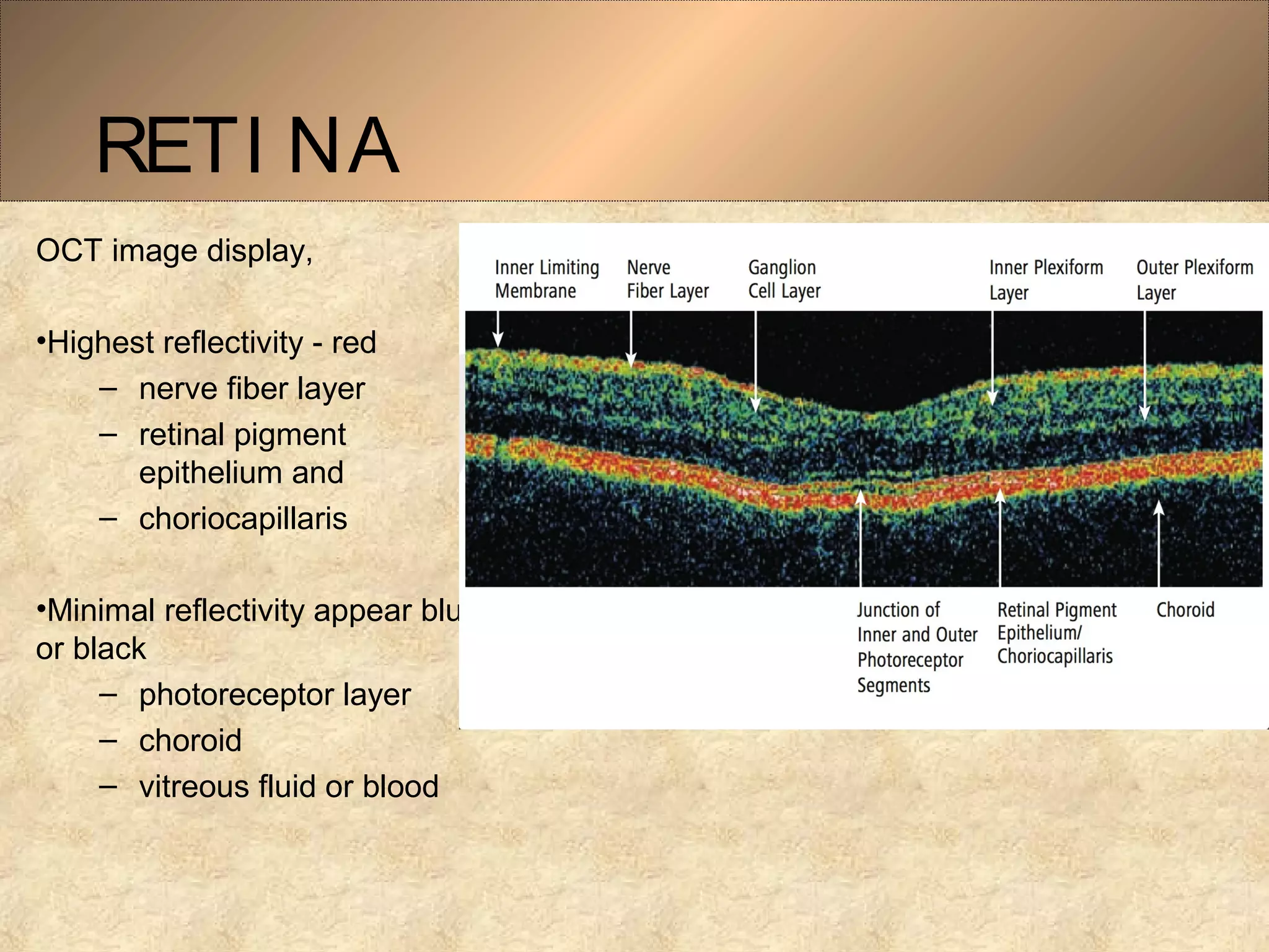 RETI NA
OCT image display,
•Highest reflectivity - red
– nerve fiber layer
– retinal pigment 
epithelium and 
– choriocapillaris 
•Minimal reflectivity appear blue 
or black
– photoreceptor layer
– choroid 
– vitreous fluid or blood 
 
