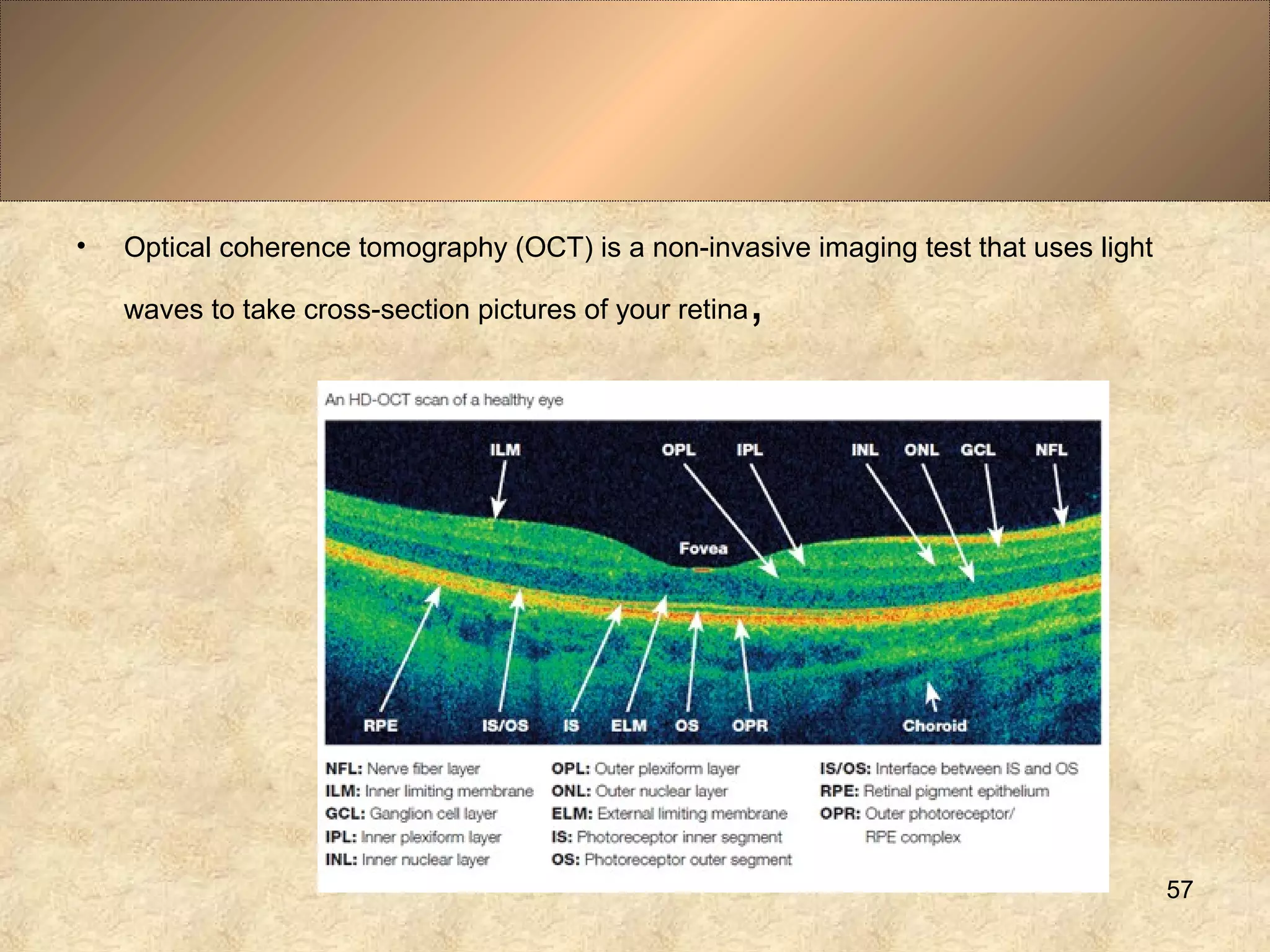 • Optical coherence tomography (OCT) is a non-invasive imaging test that uses light
waves to take cross-section pictures of your retina,
57
 