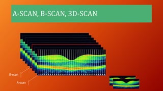 A-SCAN, B-SCAN, 3D-SCAN
A-scan
B-scan
 