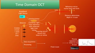 Time Domain OCT
SLD
Lens
Detector
Data Acquisition
Processing
Combines light
from reference
with reflected
light from
retina
Distance determines
depth in A scan
Reference mirror
moves back and forth
Scanning mirror
directs SLD
beam on retina
Interferometer
Broadband
Light Source
Creates
A-scan
1 pixel
at a
time
Final A-scan
Process
repeated many
times to create
B-scan
 