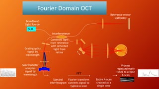 Fourier Domain OCT
SLD
Spectrometer
analyzes
signal by
wavelength FFT
Grating splits
signal by
wavelength
Broadband
Light Source
Reference mirror
stationary
Combines light
from reference
with reflected
light from
retina
Interferometer
Spectral
interferogram
Fourier transform
converts signal to
typical A-scan
Entire A-scan
created at a
single time
Process
repeated many
times to create
B-scan
 