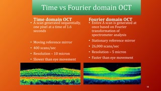 Time vs Fourier domain OCT
Time domain OCT
• A scan generated sequentially,
one pixel at a time of 1.6
seconds
• Moving reference mirror
• 400 scans/sec
• Resolution – 10 micron
• Slower than eye movement
Fourier domain OCT
• Entire A scan is generated at
once based on Fourier
transformation of
spectrometer analysis
• Stationary reference mirror
• 26,000 scans/sec
• Resolution – 5 micron
• Faster than eye movement
18
 