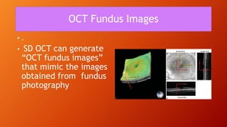OCT Fundus Images
• .
• SD OCT can generate
“OCT fundus images”
that mimic the images
obtained from fundus
photography
 