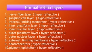 1. nerve fiber layer ( hyper reflective )
2. ganglion cell layer ( hypo reflective )
3. internal limiting membrane ( hyper reflective )
4. inner plexiform layer ( hyper reflective )
5. inner nuclear layer ( hypo reflective )
6. outer plexiform layer ( hyper reflective )
7. outer nuclear layer ( hypo reflective )
8. external limiting membrane ( hyper reflective )
9. photoreceptors ( hyper reflective )
10.pigment epithelium ( hyper reflective )
Normal retina layers
 