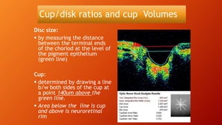 Cup/disk ratios and cup Volumes
Disc size:
 by measuring the distance
between the terminal ends
of the choriod at the level of
the pigment epithelium
(green line)
Cup:
 determined by drawing a line
b/w both sides of the cup at
a point 140um above the
green line.
 Area below the line is cup
and above is neuroretinal
rim
 