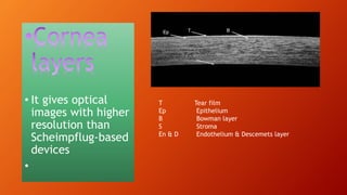 • It gives optical
images with higher
resolution than
Scheimpflug-based
devices
•
T Tear film
Ep Epithelium
B Bowman layer
S Stroma
En & D Endothelium & Descemets layer
 