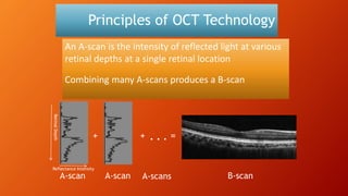 Principles of OCT Technology
An A-scan is the intensity of reflected light at various
retinal depths at a single retinal location
Combining many A-scans produces a B-scan
A-scan A-scan
+ + . . . =
B-scanA-scans
RetinalDepth
Reflectance Intensity
 