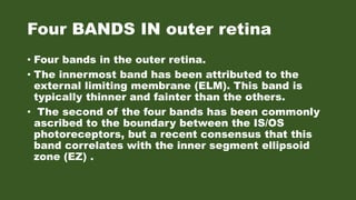 Oct demystified | PPTX