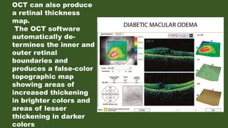 Oct Color Map Oct demystified | PPTX