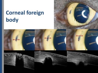 Corneal foreign
body
 
