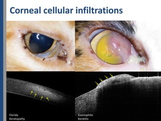 Corneal cellular infiltrations




Florida           Eosinophilic
Keratopathy       Keratitis
 