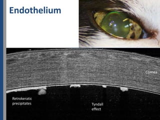 Endothelium




                         Cornea




Retrokeratic
precipitates   Tyndall
               effect
 