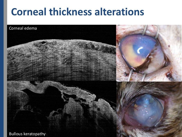 Optical Coherence Tomography of cat's cornea Evaluation de la corné…