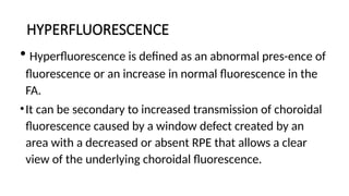 Comprehensive Overview of Fundus Fluorescein Angiography and Optical ...