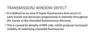 Window Defect Ffa Hyper ffa a investigation tool for retinochoroidal diseases | PPTX