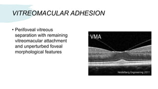 Optical Coherence Tomography | PPTX