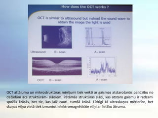 OCT attālumu un mikrostruktūras mērījumi tiek veikti ar gaismas atstarošanās palīdzību no dažādām acs struktūrām- slāņiem. Pētāmās struktūras slāņi, kas atstaro gaismu ir redzami spožās krāsās, bet tie, kas laiž cauri- tumšā krāsā. Līdzīgi kā ultraskaņas mērierīce, bet skaņas viļņu vietā tiek izmantoti elektromagnētiskie viļņi ar lielāku ātrumu. 