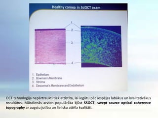 OCT tehnoloģija nepārtraukti tiek attīstīta, lai iegūtu pēc iespējas labākus un kvalitatīvākus rezultātus. Mūsdienās arvien populārāka kļūst SSOCT- sweptsourceopticalcoherencetopographyar augstu jutību un lielisku attēla kvalitāti.