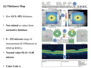 Normal Gcl Map OCT in Glaucoma umesh- showing a Glaucoma | PPTX