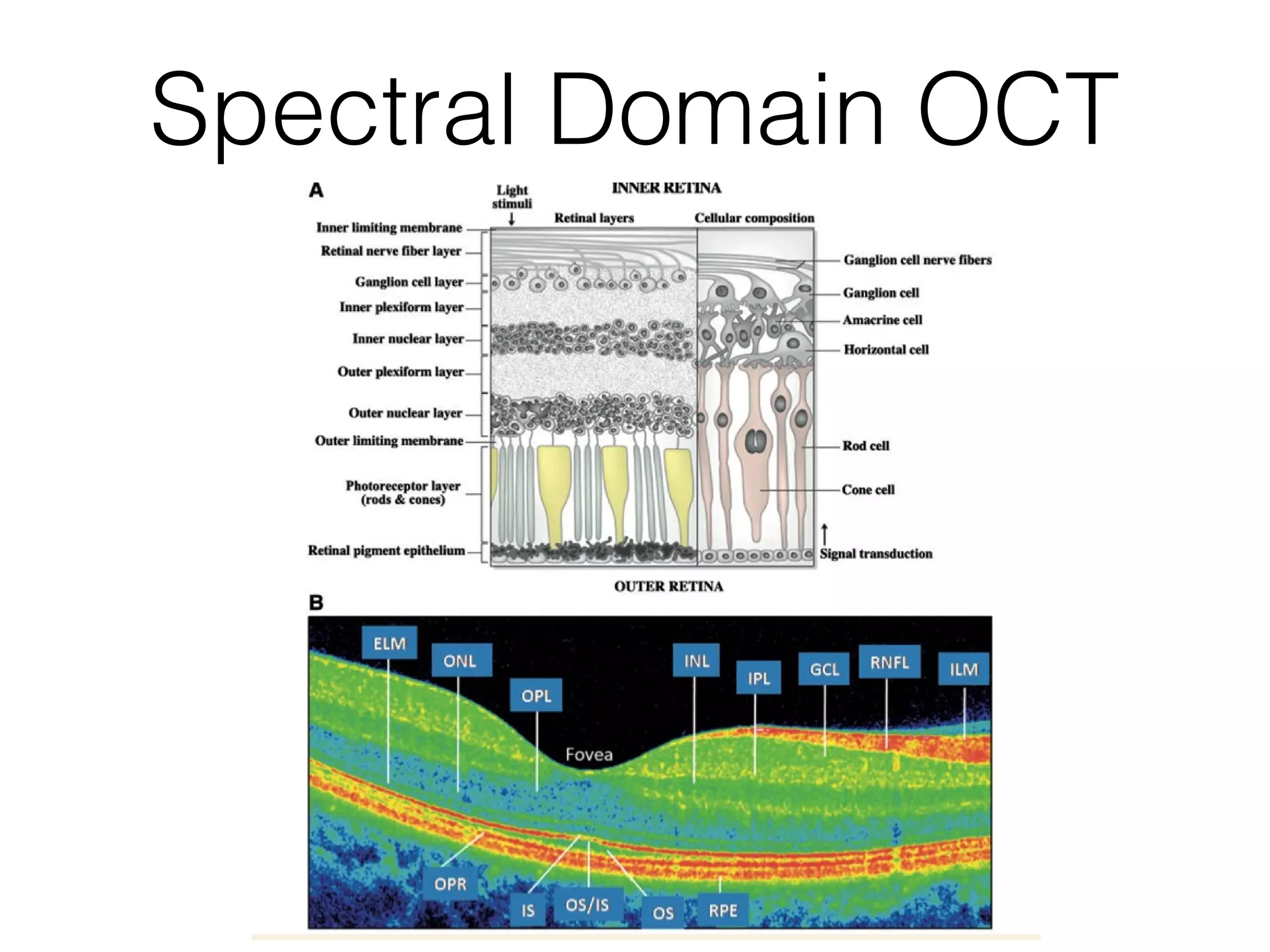 Spectral Domain OCT 
 