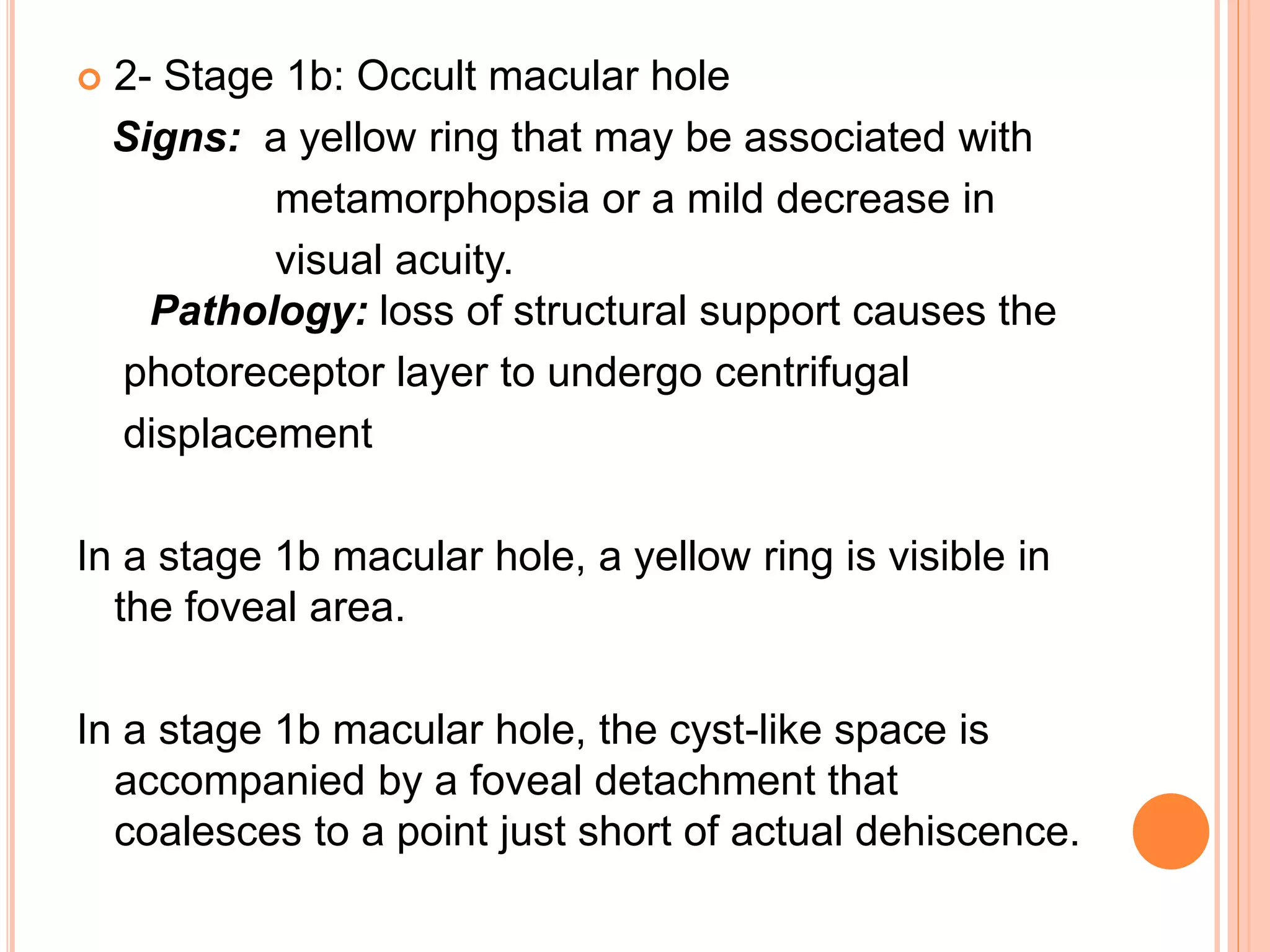  2- Stage 1b: Occult macular hole
Signs: a yellow ring that may be associated with
metamorphopsia or a mild decrease in
visual acuity.
Pathology: loss of structural support causes the
photoreceptor layer to undergo centrifugal
displacement
In a stage 1b macular hole, a yellow ring is visible in
the foveal area.
In a stage 1b macular hole, the cyst-like space is
accompanied by a foveal detachment that
coalesces to a point just short of actual dehiscence.
 