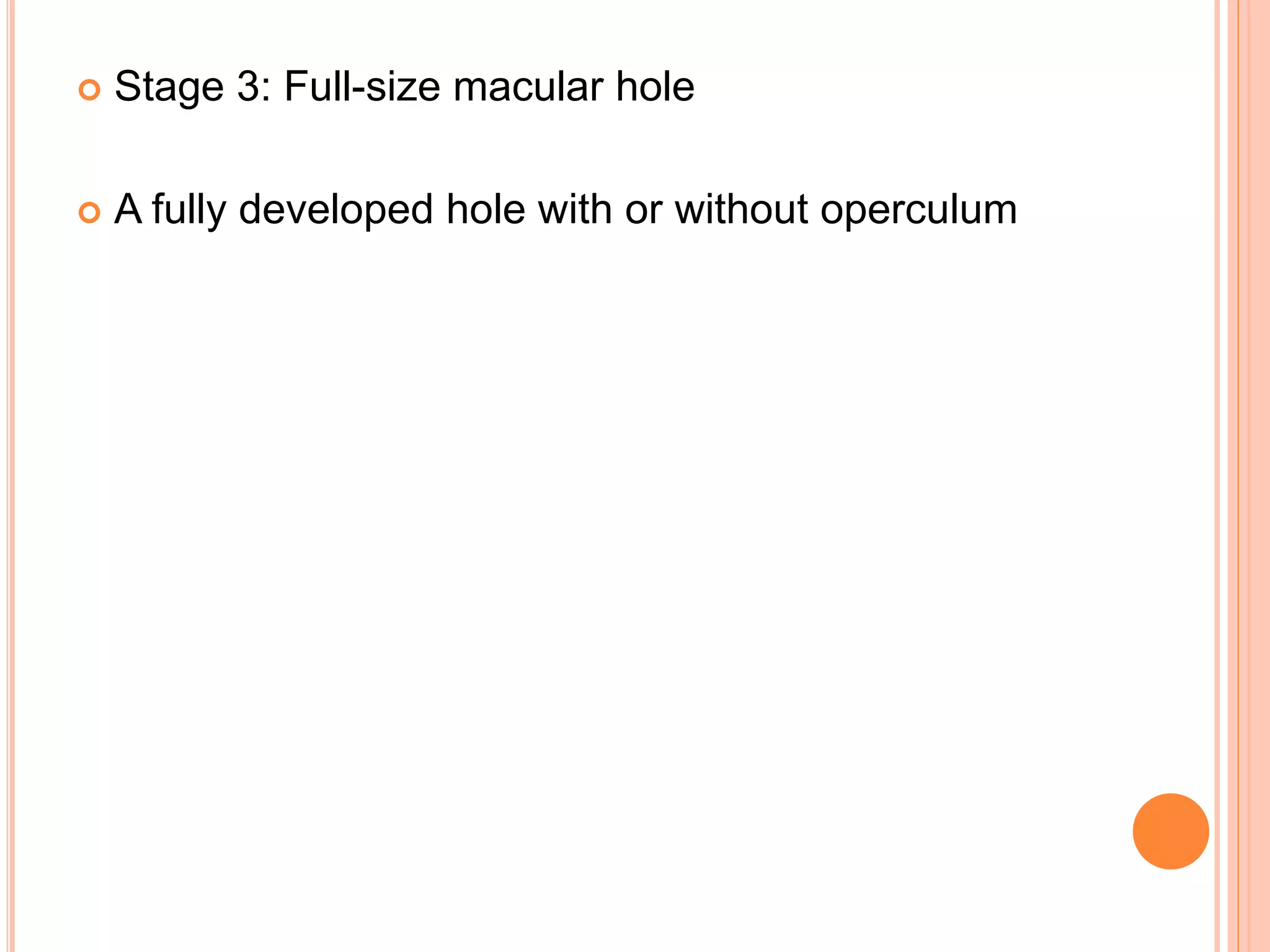  Stage 3: Full-size macular hole
 A fully developed hole with or without operculum
 
