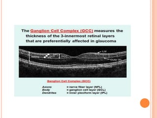 Oct Disesses Optical Coherence Tomography(OCT) in posterior segment diseases | PPT