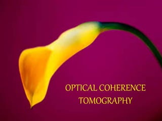 OPTICAL COHERENCE
TOMOGRAPHY
 