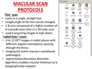MACULAR SCAN
PROTOCOLS
"line" scan
• scans in a single, straight line.
• Length,angle of the line can be changed
• 1 B-scan composed of a higher number of
A-scans/B-scans than in a 3D cube scan.
• used 4 acquiring images in high detail.
"radial lines" scans
• 6 to 12 OCT images in radial planes with
different angular orientations, passing
through the fovea.
• imaging the entire macula n extrafoveal
pathologies.
• segmentation/boundary detection
algorithms enables macular thickness to b
topographically mapped.
 