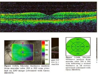 Retinal Topographic Mapping and Analysis
• segmented 3D data sets retinal images are used to form a 2D
topographic data set that can be displayed in false color as an overlay
• Retinal thickness between 0 and 500 μm are displayed by colors
ranging from blue to red, as shown in the bar index.
 